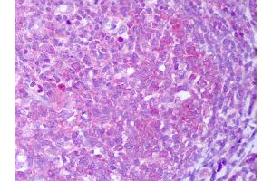 Anti-IL-13 antibody IHC of human tonsil, germinal center. (IL-13 抗体)