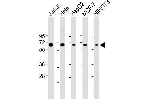 All lanes : Anti-PSMD3 Antibody (C-Term) at 1:2000 dilution Lane 1: Jurkat whole cell lysate Lane 2: Hela whole cell lysate Lane 3: HepG2 whole cell lysate Lane 4: MCF-7 whole cell lysate Lane 5: NIH/3T3 whole cell lysate Lysates/proteins at 20 μg per lane. (PSMD3 抗体  (AA 482-515))