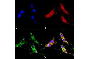 Immunocytochemistry/Immunofluorescence analysis using Mouse Anti-VGLUT2 Monoclonal Antibody, Clone S29-29 (ABIN2483733). (Solute Carrier Family 17 (Vesicular Glutamate Transporter), Member 6 (SLC17A6) (AA 501-582) 抗体 (Atto 390))