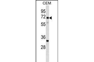 NPLOC4 Antibody (C-term) (ABIN1537359 and ABIN2848982) western blot analysis in CEM cell line lysates (35 μg/lane). (NPLOC4 抗体  (C-Term))