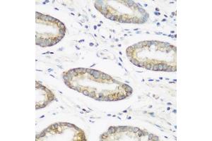 Immunohistochemistry of paraffin-embedded human gastric using NEDD4 antibody (ABIN1681009, ABIN3015207, ABIN3015208 and ABIN6213883) at dilution of 1:200 (40x lens). (NEDD4 抗体  (AA 160-460))