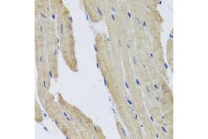 Immunohistochemistry of paraffin-embedded mouse heart using PRPH antibody (ABIN5972212) at dilution of 1/100 (40x lens). (Peripherin 抗体)