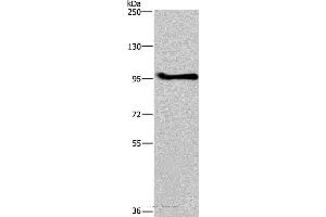 Western blot analysis of A549 cell, using LLGL1 Polyclonal Antibody at dilution of 1:350 (LLGL1 抗体)