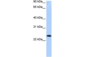 Western Blotting (WB) image for anti-Egl-9 Family Hypoxia Inducible Factor 3 (EGLN3) antibody (ABIN2463514) (EGLN3 抗体)