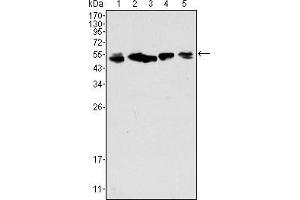 Western blot analysis using CK8 mouse mAb against A549 (1), Hela (2), MCF-7 (3), A431 (4) and HepG2 (5) cell lysate. (KRT8 抗体  (AA 391-483))