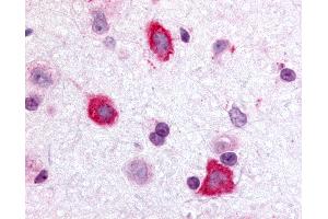 Anti-GALR3 antibody IHC of rat brain, hippocampus. (GALR3 抗体  (Cytoplasmic Domain))