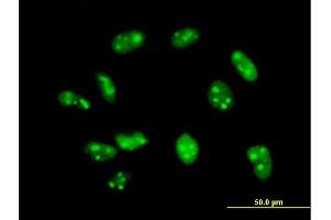 Immunofluorescence of purified MaxPab antibody to EXOSC7 on HeLa cell. (EXOSC7 抗体  (AA 1-291))
