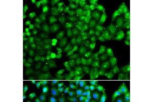 Immunofluorescence analysis of A549 cells using HLA-DRB1 Polyclonal Antibody (HLA-DRB1 抗体)