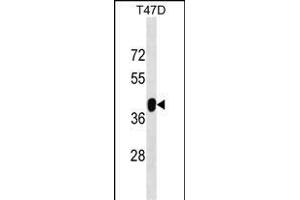 ZNF322A Antibody (C-term) (ABIN1537135 and ABIN2848990) western blot analysis in T47D cell line lysates (35 μg/lane). (ZNF322A 抗体  (C-Term))