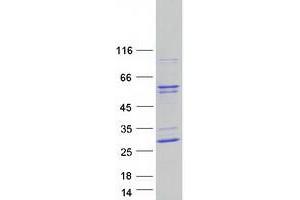 Western Blotting (WB) image for Inositol Hexakisphosphate Kinase 2 (IP6K2) (Transcript Variant 1) protein (Myc-DYKDDDDK Tag) (ABIN2723500)