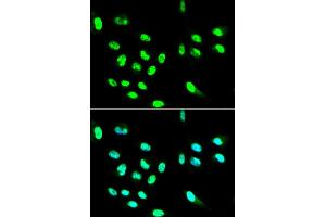 Immunofluorescence analysis of HepG2 cell using FCGR2A antibody. (FCGR2A 抗体)