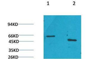 Western Blot (WB) analysis of 1) Rat Brain Tissue, 2)Mouse Brain Tissue with GLP1R Rabbit Polyclonal Antibody diluted at 1:2000. (GLP1R 抗体)