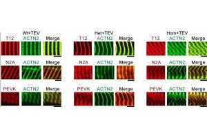 Fluorescence Microscopy (FM) image for Goat anti-Mouse IgG (F(ab')2 Region) antibody (FITC) (ABIN101828)