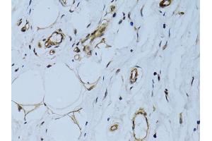Immunohistochemistry of paraffin-embedded human breast using MCAM antibody (ABIN6290150) at dilution of 1:100 (40x lens). (MCAM 抗体)