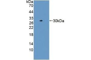 Detection of Recombinant LACTb, Human using Polyclonal Antibody to Lactamase Beta (LACTb) (LACTB 抗体  (AA 313-547))