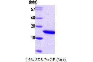 SDS-PAGE (SDS) image for Retinol Binding Protein 4, Plasma (RBP4) protein (ABIN667703) (RBP4 蛋白)