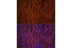 Immunofluorescence analysis of rat kidney using PCK1 Rabbit pAb (ABIN3022753, ABIN3022754, ABIN3022755 and ABIN6219210) at dilution of 1:100 (40x lens).
