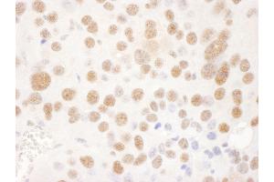 Immunohistochemistry (IHC) image for anti-Ubiquitin Specific Peptidase 7 (Herpes Virus-Associated) (USP7) (AA 1-50) antibody (ABIN7453454) (USP7 抗体  (AA 1-50))