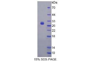 SDS-PAGE analysis of Mouse FBS Protein.