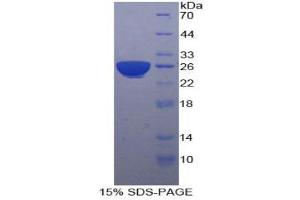 SDS-PAGE (SDS) image for Pregnancy Specific beta-1-Glycoprotein 1 (PSG1) (AA 202-401) protein (His tag) (ABIN1880069)