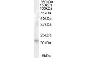 ABIN238569 (1µg/ml) staining of Human Liver lysate (35µg protein in RIPA buffer). (FGF21 抗体  (Internal Region))