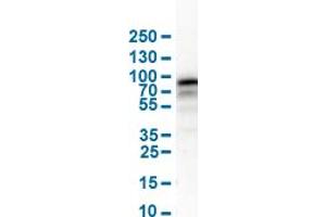 Western Blot analysis of human cell line RH-30. (NGFR 抗体  (AA 281-421))