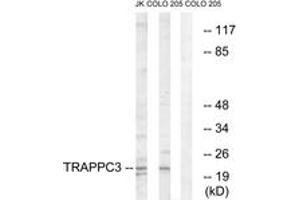 Western blot analysis of extracts from COLO/Jurkat cells, using TRAPPC3 Antibody. (TRAPPC3 抗体  (AA 131-180))