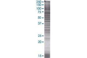 ELA3A transfected lysate. (ELA3A 293T Cell Transient Overexpression Lysate(Denatured))