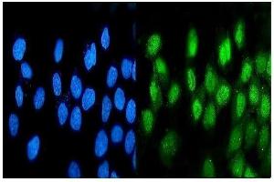 IF analysis of ATF1 using anti-ATF1 antibody (ABIN7599192). (AFT1 抗体  (AA 1-271))