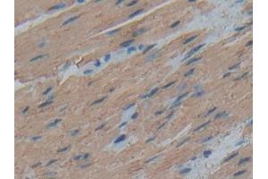 DAB staining on IHC-P; Samples: Human Esophagus Tissue (ACTC1 抗体  (AA 156-368))