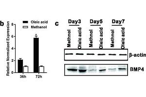 BMP4 expression is elevated during Oleic acid-induced triglyceride/lipid accumulation in hepatocytes and in a mouse model of NAFLD.
