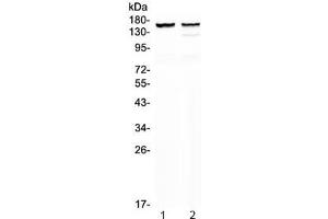 Western blot testing of 1) rat heart and 2) mouse heart lysate with MYBPC3 antibody at 0. (MYBPC3 抗体)