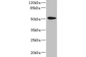 Western blot All lanes: KRT35 antibody at 4 μg/mL + PC-3 whole cell lysate Secondary Goat polyclonal to rabbit IgG at 1/10000 dilution Predicted band size: 51 kDa Observed band size: 51 kDa (Keratin 35 抗体  (AA 1-455))