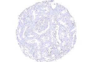 CELA3B immunostaining is absent in kidney tissue (Recombinant Elastase 3B 抗体  (AA 82-238))