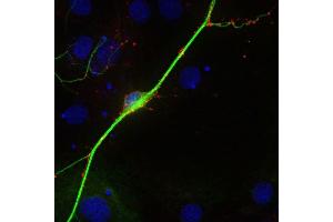 Indirect immunostaining of PFA fixed rat hippocampus neurons with anti-synaptoporin (1 : 500; red) and mouse anti-MAP 2 (, dilution 1 : 500; green).