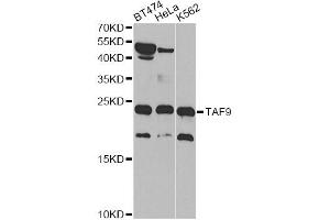 Western blot analysis of extracts of various cell lines, using TAF9 antibody (ABIN5971055) at 1/1000 dilution. (TAF9 抗体)