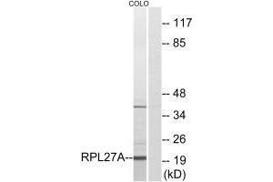 Western blot analysis of extracts from COLO cells, using RPL27A antibody. (RPL27A 抗体  (C-Term))