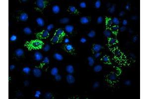 Image no. 4 for anti-Dihydrolipoamide Dehydrogenase (DLD) antibody (ABIN1497849)