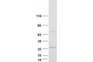 Western Blotting (WB) image for Calcyphosine-Like (CAPSL) (Transcript Variant 2) protein (Myc-DYKDDDDK Tag) (ABIN2713044)