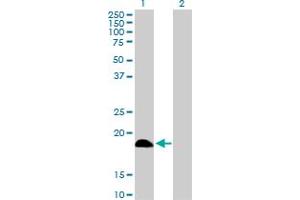 Western Blot analysis of DCTD expression in transfected 293T cell line by DCTD MaxPab polyclonal antibody. (DCMP Deaminase (DCTD) (AA 1-189) 抗体)