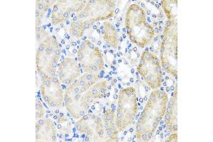Immunohistochemistry of paraffin-embedded mouse kidney using PSTPIP1 antibody (ABIN5975180) at dilution of 1/100 (40x lens). (PSTPIP1 抗体)