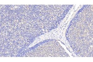 Detection of EMR1 in Human Lymph node Tissue using Polyclonal Antibody to EGF Like Module Containing Mucin Like Hormone Receptor 1 (EMR1) (F4/80 抗体  (AA 1-201))