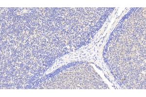 Detection of EMR1 in Human Lymph node Tissue using Polyclonal Antibody to EGF Like Module Containing Mucin Like Hormone Receptor 1 (EMR1)