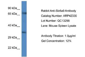 Host:  Rabbit  Target Name:  SLC6A9  Sample Tissue:  Mouse Spleen  Antibody Dilution:  1ug/ml (GLYT1 抗体  (C-Term))