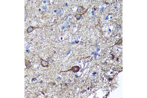 Immunohistochemistry (IHC) image for anti-GULP, Engulfment Adaptor PTB Domain Containing 1 (GULP1) (AA 1-130) antibody (ABIN6141541)
