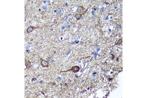 Immunohistochemistry of paraffin-embedded Mouse spinal cord using GULP1 Rabbit pAb (ABIN6131564, ABIN6141541, ABIN6141542 and ABIN6220256) at dilution of 1:100 (40x lens). (GULP1 抗体  (AA 1-130))