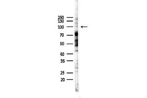 Western blot analysis of lysates from Rat brain, using CBCP2 Antibody at 1/1000 dilution.