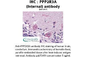 Image no. 1 for anti-Protein Phosphatase 2, Regulatory Subunit B'', alpha (PPP2R3A) (Internal Region) antibody (ABIN1738304)