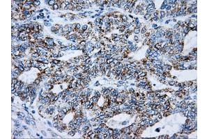 Immunohistochemistry (IHC) image for anti-ATP Synthase, H+ Transporting, Mitochondrial F1 Complex, beta Polypeptide (ATP5B) antibody (ABIN1496769)