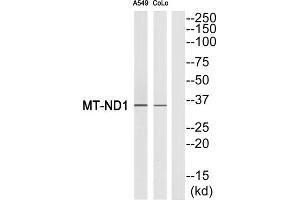 Western blot analysis of extracts from A549 cells and COLO cells, using MT-ND1 antibody.